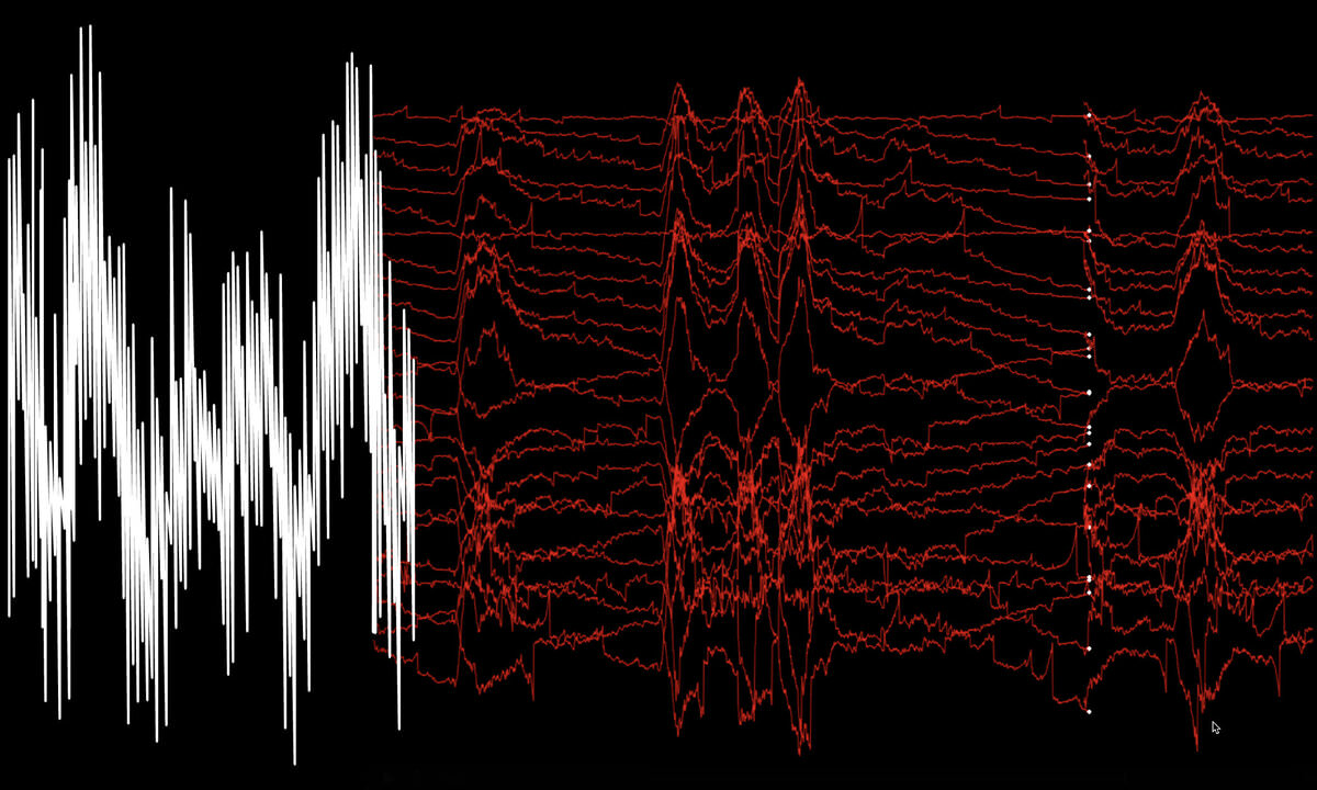 Simulated EEG-Driven Audio Information Mapping Using Inner Hair-Cell Model and Spiking Neural Network
